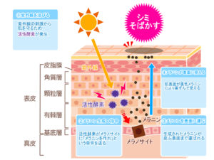 シミ・そばかすの発生メカニズムの写真画像